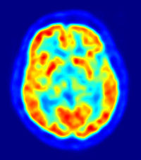 Brain Imaging and Analysis image